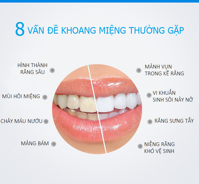 8 vấn đề răng miệng hay mắc